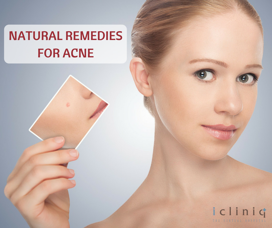 6 Quick and Crunchy Home Remedies for Acne