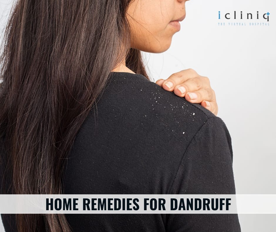Home Remedies For Dandruff