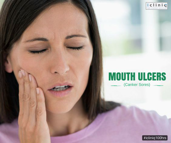 7 Home Remedies To Cure Mouth Ulcers