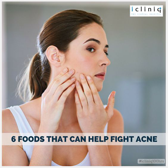 6 Foods That Can Help Fight Acne