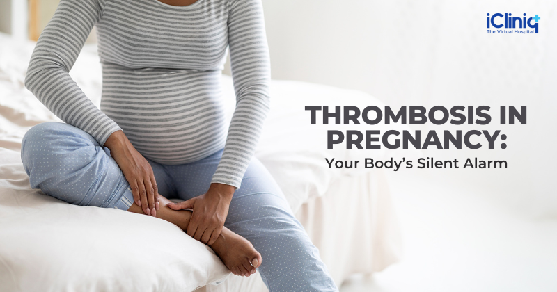 Thrombosis in Pregnancy: Your Body’s Silent Alarm