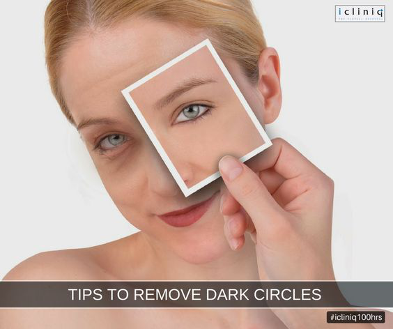 Tips to Remove Dark Circles Under Eyes