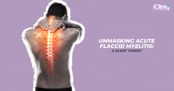 Unmasking Acute Flaccid Myelitis: A Silent Threat