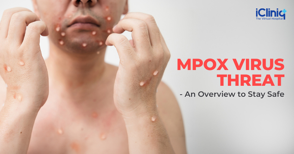 Mpox Virus Threat - An Overview to Stay Safe