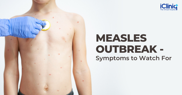 Measles Outbreak - Symptoms to Watch For