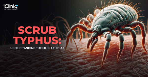 Scrub Typhus: The Hidden Threat You Need to Know About